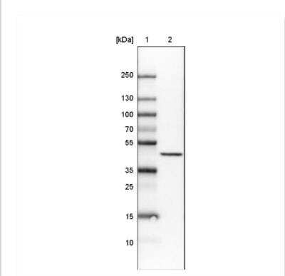 Western Blot: CS Citrate Synthase Antibody (CL2553) [NBP2-36773]