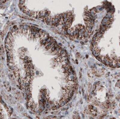 Immunohistochemistry: CS Citrate Synthase Antibody (CL2561) [NBP2-36774]