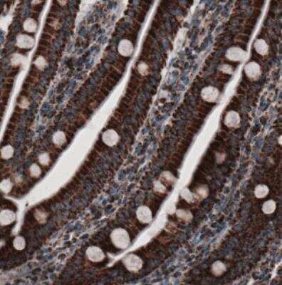 Immunohistochemistry: CS Citrate Synthase Antibody (CL2561) [NBP2-36774]