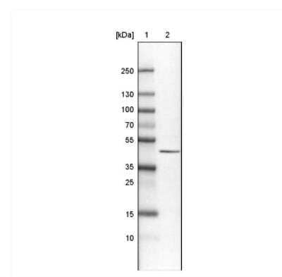 Western Blot: CS Citrate Synthase Antibody (CL2561) [NBP2-36774]