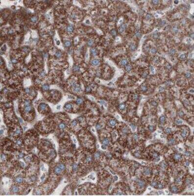 Immunohistochemistry: CS Citrate Synthase Antibody (CL2579) [NBP2-36775]