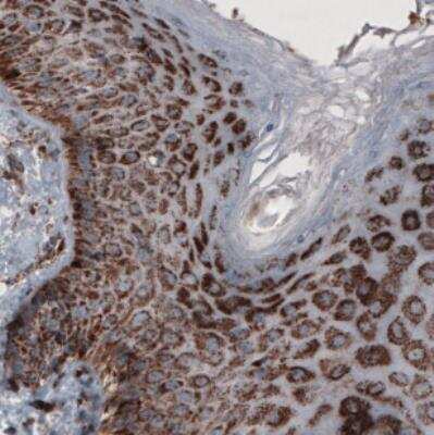Immunohistochemistry: CS Citrate Synthase Antibody (CL2579) [NBP2-36775]