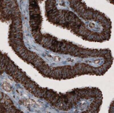 Immunohistochemistry: CS Citrate Synthase Antibody (CL2579) [NBP2-36775]