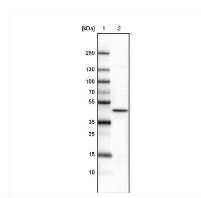 Western Blot: CS Citrate Synthase Antibody (CL2579) [NBP2-36775]