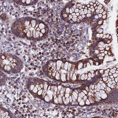Immunohistochemistry-Paraffin: CS Citrate Synthase Antibody [NBP2-13877]