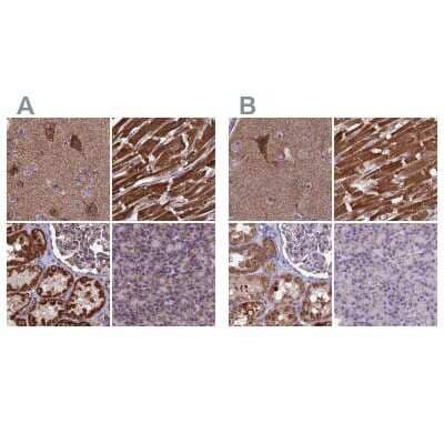 Immunohistochemistry-Paraffin: CS Citrate Synthase Antibody [NBP2-13878]