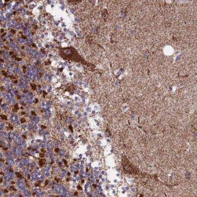 Immunohistochemistry-Paraffin: CS Citrate Synthase Antibody [NBP2-13878]