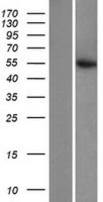 Western Blot: CS Citrate Synthase Overexpression Lysate [NBP2-04262]