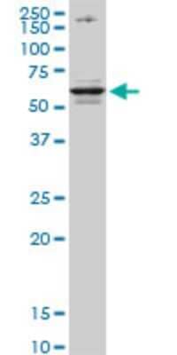 Western Blot: CSAD Antibody (2C11) [H00051380-M02]