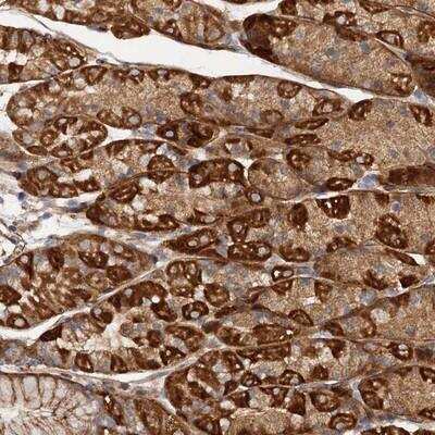 Immunohistochemistry-Paraffin: CSAD Antibody [NBP1-84373]