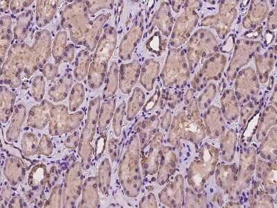 Immunohistochemistry-Paraffin: CSAD Antibody [NBP2-97312]