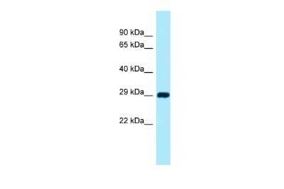 Western Blot: CSAD Antibody [NBP2-87219]