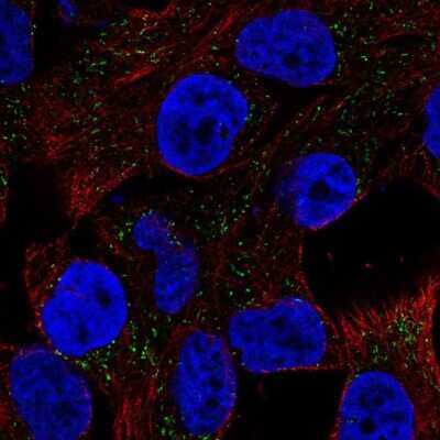 Immunocytochemistry/ Immunofluorescence: CSAG1 Antibody [NBP2-69065]