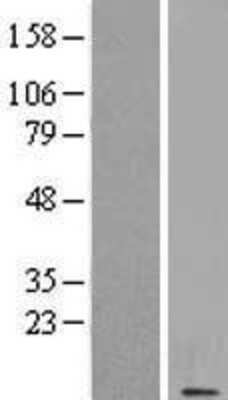 Western Blot: CSAG1 Overexpression Lysate [NBL1-09508]