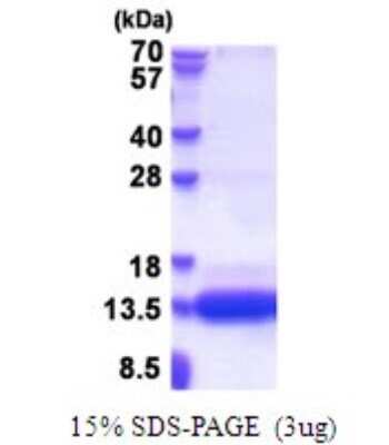 SDS-PAGE: Recombinant Human CSAG1 His Protein [NBP2-51657]