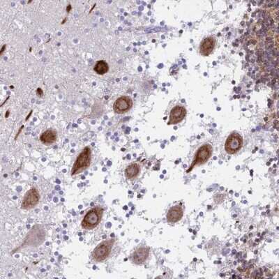 Immunohistochemistry: CSAP Antibody [NBP2-33394]