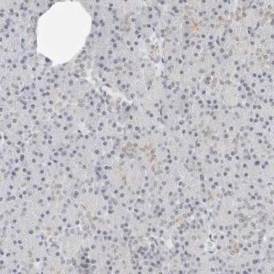 Immunohistochemistry-Paraffin: CSAP Antibody [NBP1-83446]