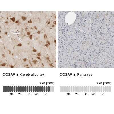 Immunohistochemistry-Paraffin: CSAP Antibody [NBP1-83446]