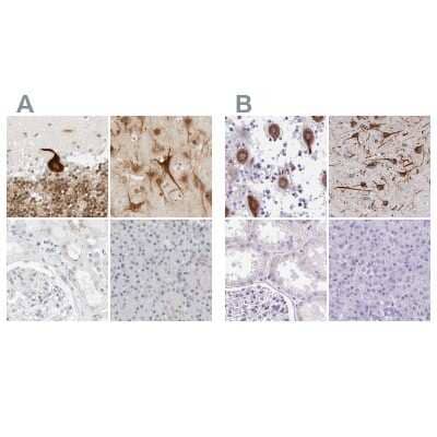 Immunohistochemistry-Paraffin: CSAP Antibody [NBP1-83446]