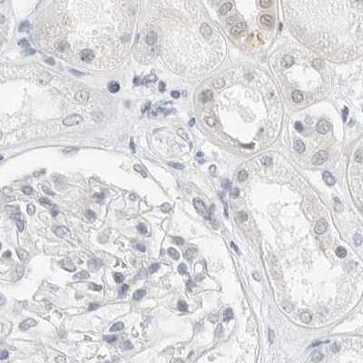 Immunohistochemistry-Paraffin: CSAP Antibody [NBP1-83446]