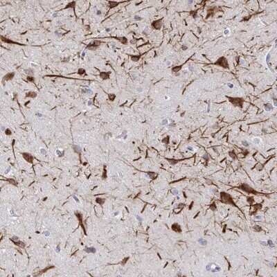 Immunohistochemistry-Paraffin: CSAP Antibody [NBP2-33394]