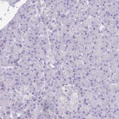 Immunohistochemistry-Paraffin: CSAP Antibody [NBP2-33394]