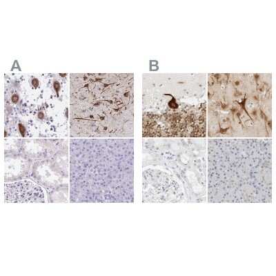 Immunohistochemistry-Paraffin: CSAP Antibody [NBP2-33394]
