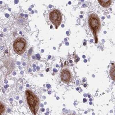 Immunohistochemistry-Paraffin: CSAP Antibody [NBP2-33394]