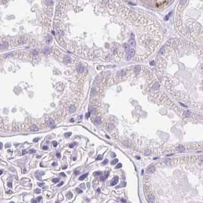 Immunohistochemistry-Paraffin: CSAP Antibody [NBP2-33394]