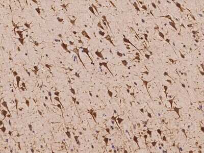 Immunohistochemistry-Paraffin: CSAP Antibody [NBP2-98036]