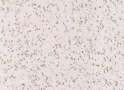 Immunohistochemistry-Paraffin: CSAP Antibody [NBP3-12784]