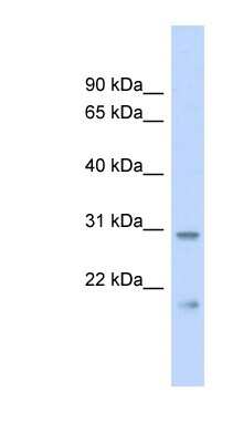 Western Blot: CSAP Antibody [NBP1-70458]