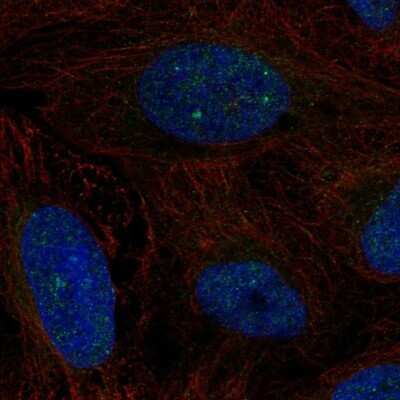 Immunocytochemistry/ Immunofluorescence: CSB Antibody [NBP2-68917]