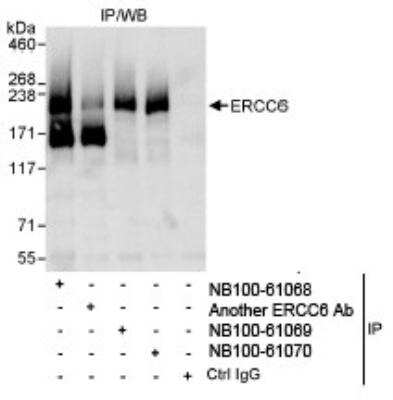 Immunoprecipitation: CSB Antibody [NB100-61070]