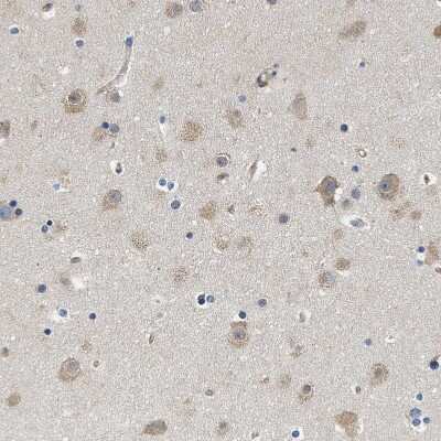Immunohistochemistry-Paraffin: CSDE1 Antibody [NBP1-85341]
