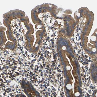 Immunohistochemistry-Paraffin: CSDE1 Antibody [NBP1-85341]