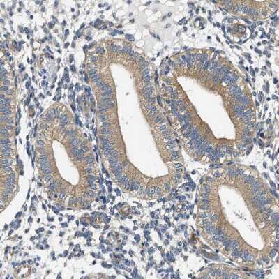 Immunohistochemistry-Paraffin: CSDE1 Antibody [NBP1-85341]