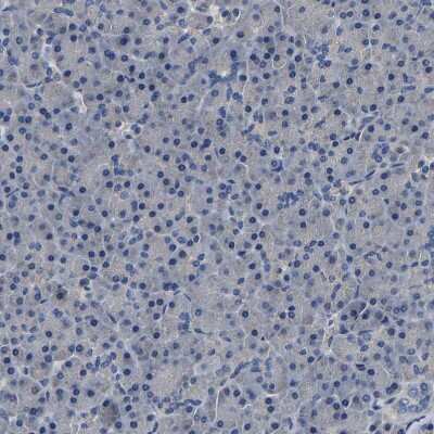 Immunohistochemistry-Paraffin: CSDE1 Antibody [NBP1-85341]