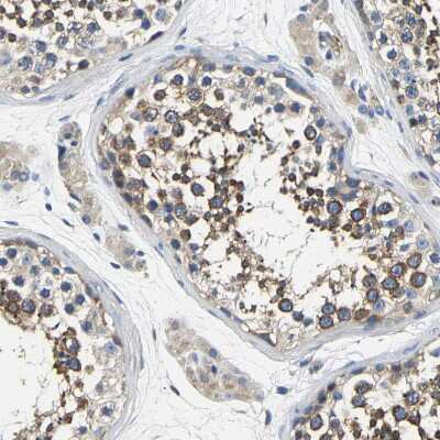Immunohistochemistry-Paraffin: CSDE1 Antibody [NBP1-85341]