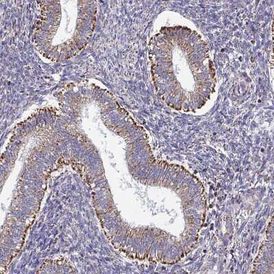 Immunohistochemistry-Paraffin: CSDE1 Antibody [NBP2-38665]