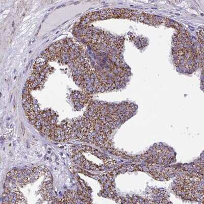 Immunohistochemistry-Paraffin: CSDE1 Antibody [NBP2-38665]