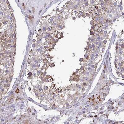 Immunohistochemistry-Paraffin: CSDE1 Antibody [NBP2-38665]
