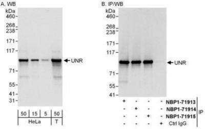 Western Blot: CSDE1 Antibody [NBP1-71913]