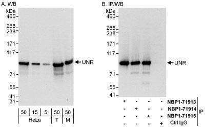 Western Blot: CSDE1 Antibody [NBP1-71915]