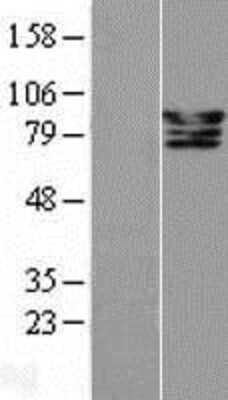 Western Blot: CSDE1 Overexpression Lysate [NBL1-09511]