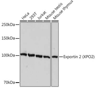 Western Blot: CSE1L/CAS/Exportin-2 Antibody (1W4T4) [NBP3-15330]