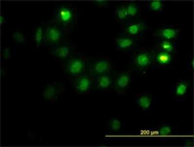 Immunocytochemistry/ Immunofluorescence: CSE1L/CAS/Exportin-2 Antibody (2B7) [H00001434-M01]