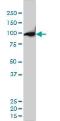 Western Blot: CSE1L/CAS/Exportin-2 Antibody (2B7) [H00001434-M01]