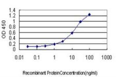 ELISA: CSE1L/CAS/Exportin-2 Antibody (2C10) [H00001434-M03]