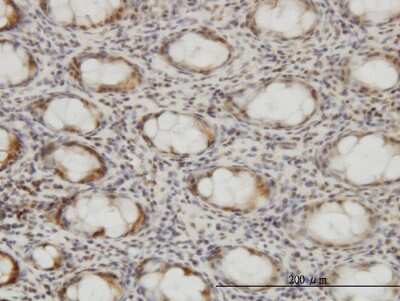 Immunohistochemistry-Paraffin: CSE1L/CAS/Exportin-2 Antibody (2C10) [H00001434-M03]
